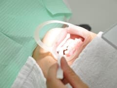 ホワイトニング剤を塗布してもらっている女性