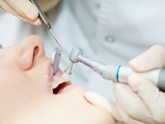 歯のコーディングをしてもらっている女性