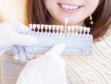 シェードチェックをしてもらっている女性