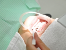 ホワイトニング剤を塗布してもらっている女性