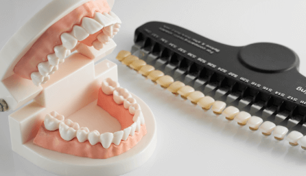 歯の模型とシェードガイド